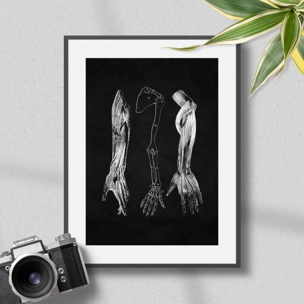 Plakat dla fizjoterapeuty - Przedramię